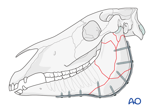 mandible vertical ramus