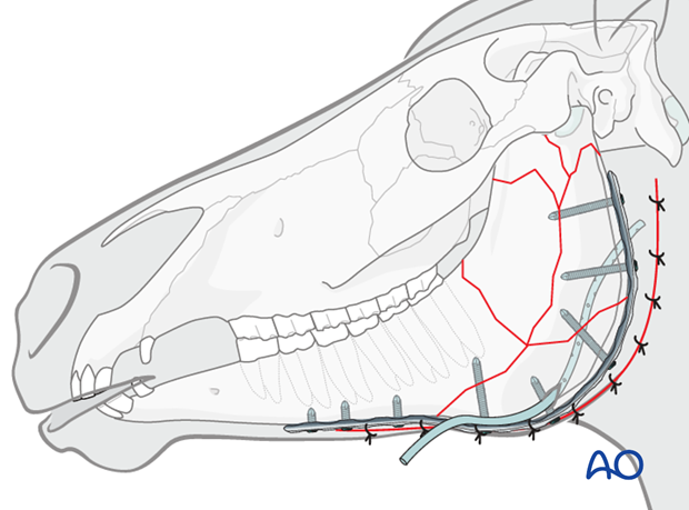 plate fixation