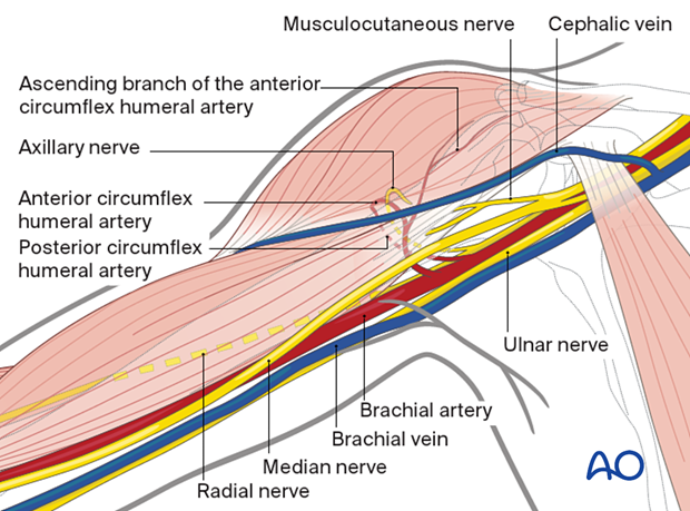 This approach uses an avascular plane, avoiding anterior and posterior circumflex humeral arteries.