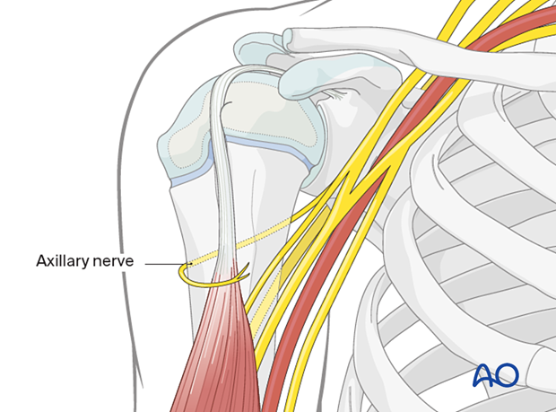 Note axillary nerve course: anterior motor branch crosses humerus ~5 cm distal to acromion in children 6+ years; distance varies with size.