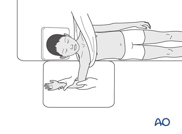 Reduction of pediatric proximal humeral fracture 