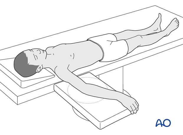 The supine patient position