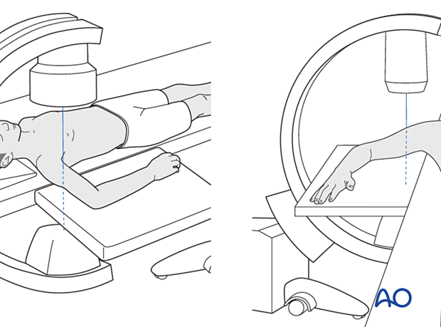 Supine position - C-arm positioning