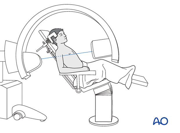 C-arm positioning