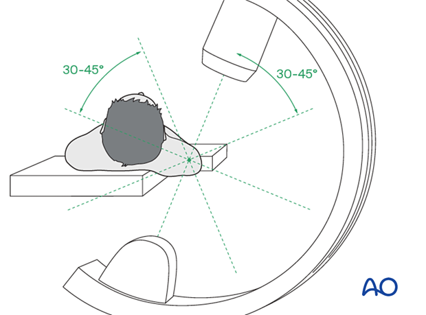 C-arm positioning