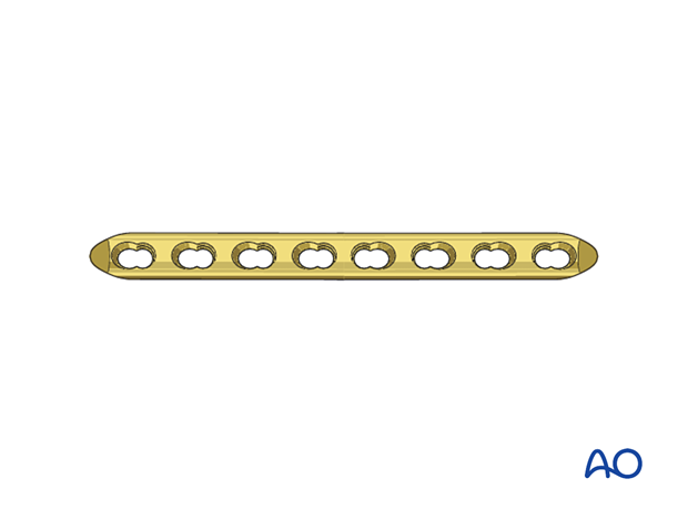 Compression plating of pediatric humeral shaft fracture, with plates allowing sufficient screws for stability.