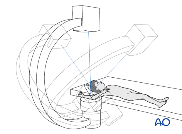 closed reduction splint immobilization