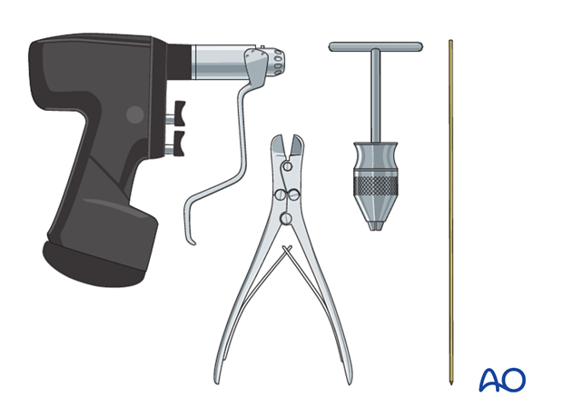 open reduction k wire fixation