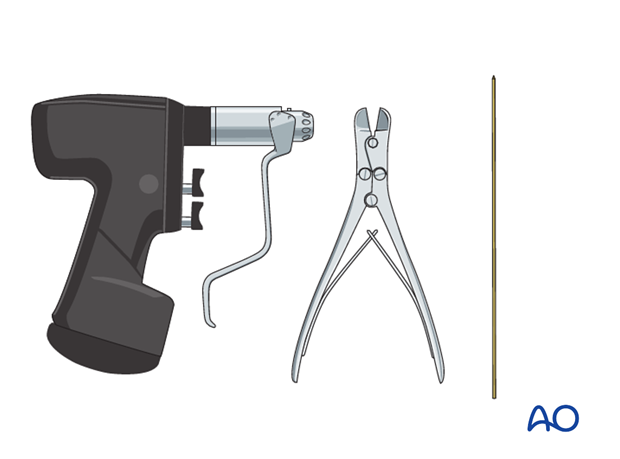 closed reduction k wire fixation