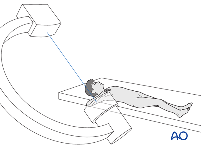 ESIN for Simple metaphyseal, complete with/without contact between ...