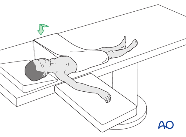 Supine position for casting