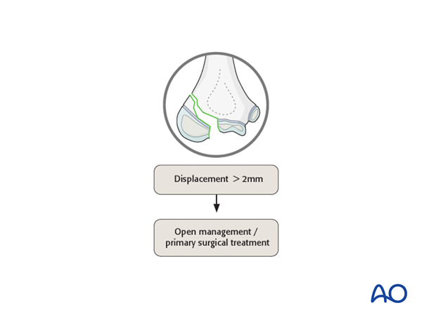 treatment algorithm for intraarticular fractures of the distal humerus
