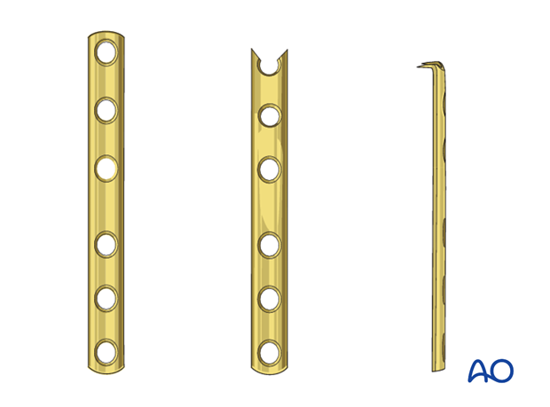 Open reduction; plate fixation (olecranon) - Hook plate