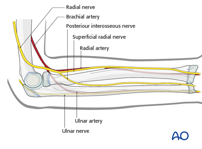 Safe zones for pin placement in the pediatric radius