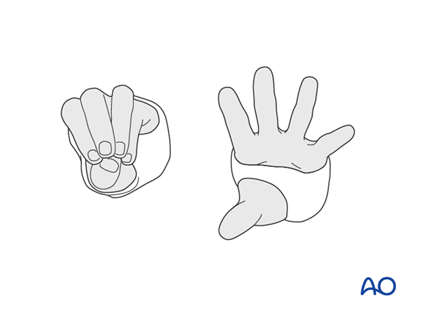 Flexion of MCP joints