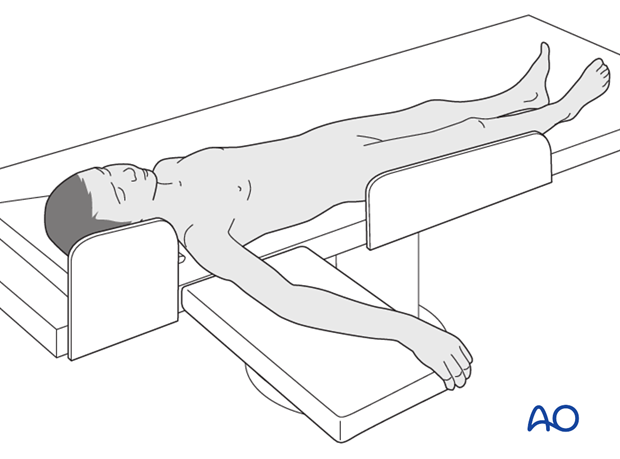 Supine position for casting