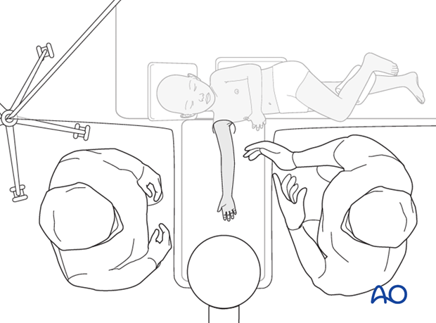 Supine position for casting