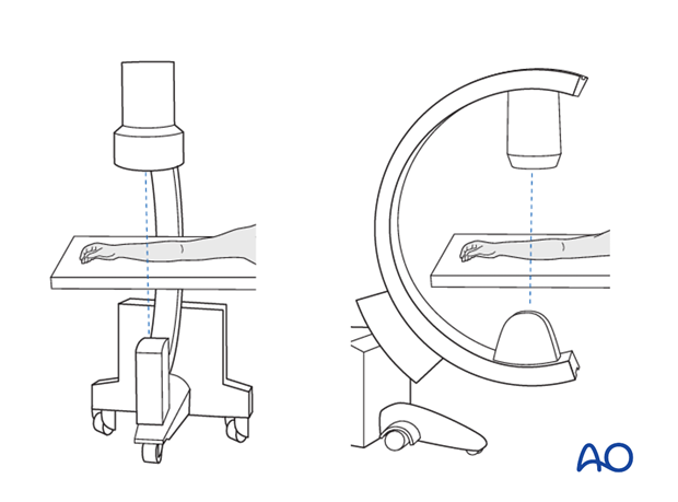 C-arm positioning