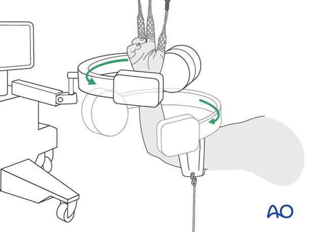 Supine position for casting