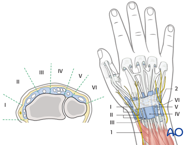 Closed reduction; K-wire fixation for Metaphyseal, simple complete ...