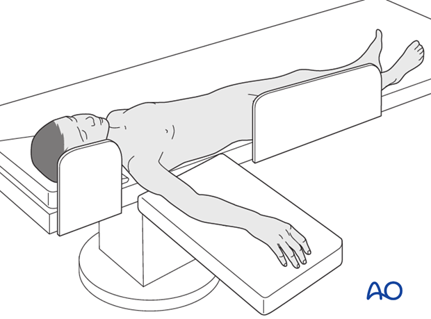 Supine position for casting