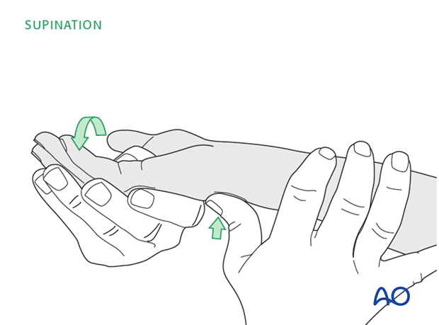 Supine position for casting