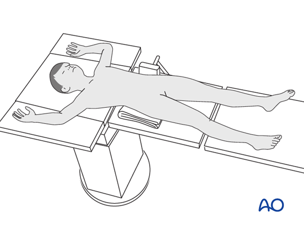 Supine position