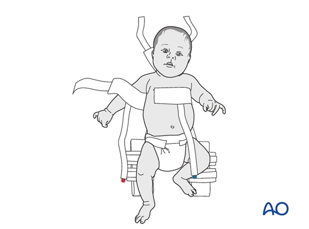 Placement of infant on top of harness