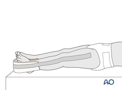 Traction for Complete transverse, simple