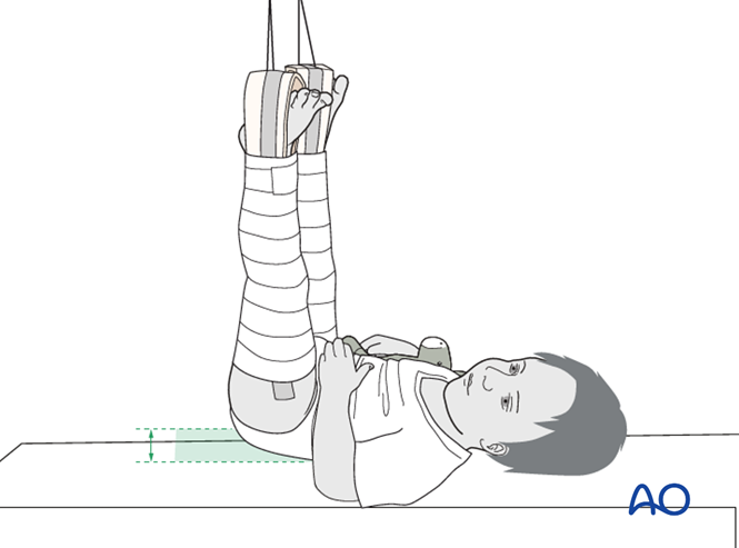 Compression Traction Signe Traction for Complete transverse, simple
