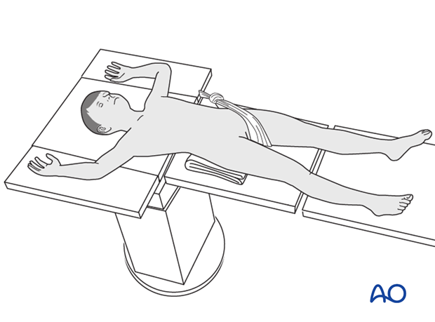 Supine patient position