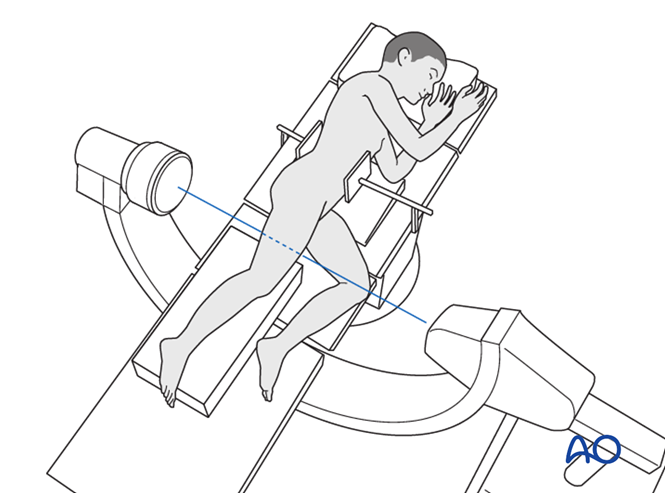 Patient preparation in lateral position