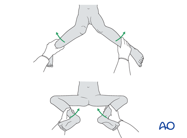 Checking the range of internal and external leg rotation