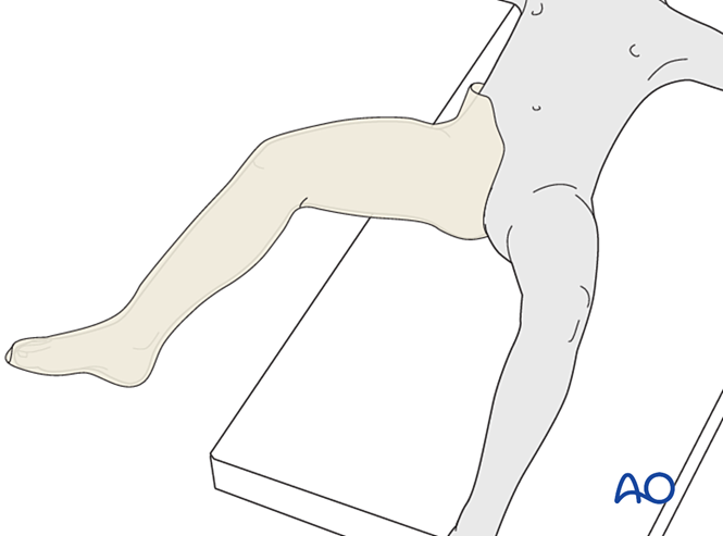 Long leg cast