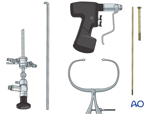 Instruments and implants for reduction and screw fixation with arthroscopic assistance