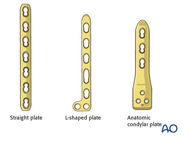 Plate types for fixation of distal femur fractures