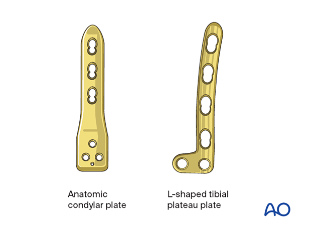 Plate types for fixation of distal femur fractures