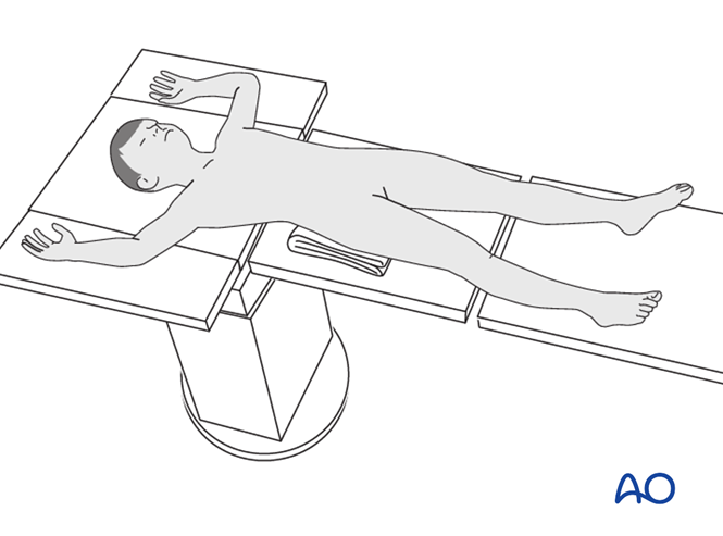 Patient preparation in supine position