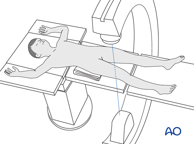 C-arm positioning