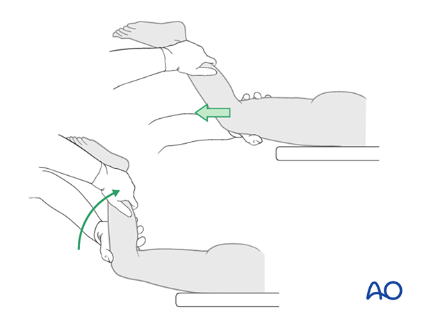 Prone patient positioning and reduction