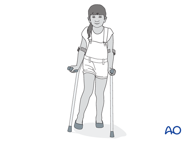 Female pediatric patient walking with crutches