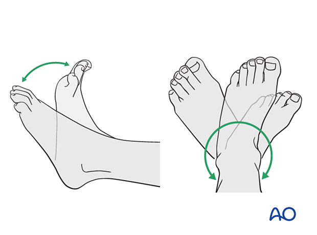 Mobilization of the ankle