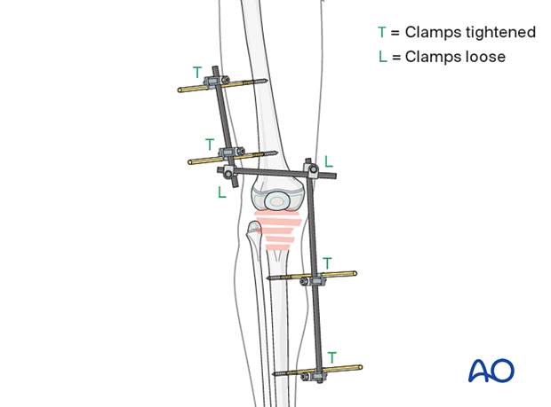 Frame assembly