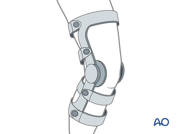 Hinged knee brace with gradually increasing range of motion