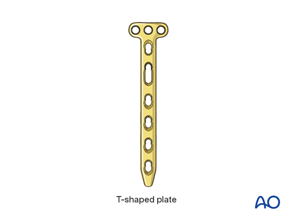 T-shaped LCP plate