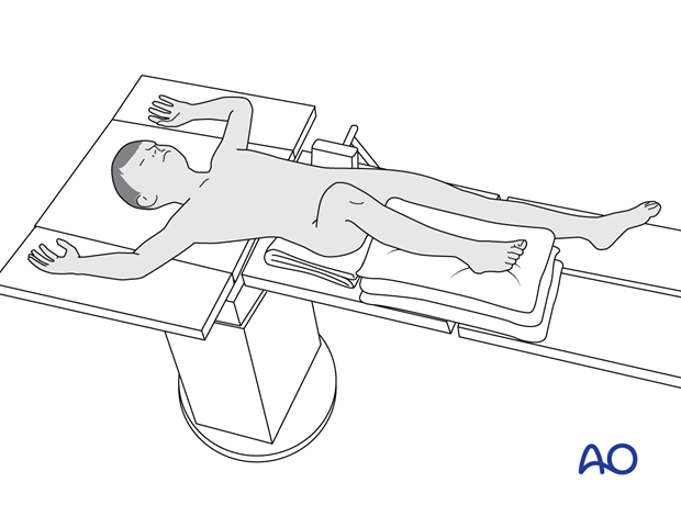 Supine position of a pediatric patient for surgery of the tibia with the leg elevated