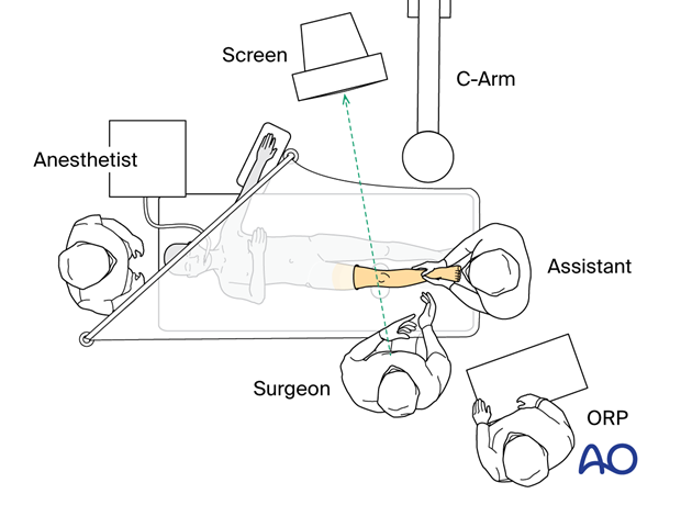 Supine position of a pediatric patient for surgery of the proximal tibial - OR set-up