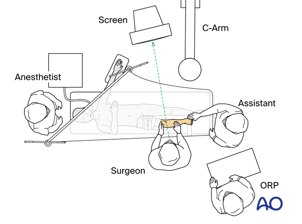 OR set-up for surgery of the pediatric tibia with arthroscopy 