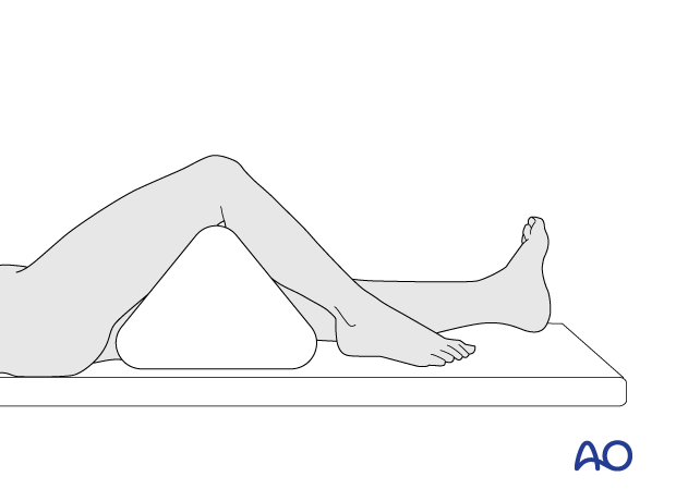 Patient supine with a bolster under the knee