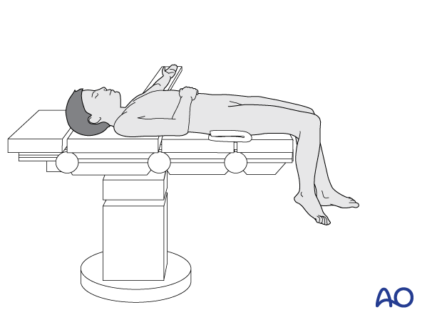 Pediatric patient positioned supine on an operating table with the legs hanging over the edge